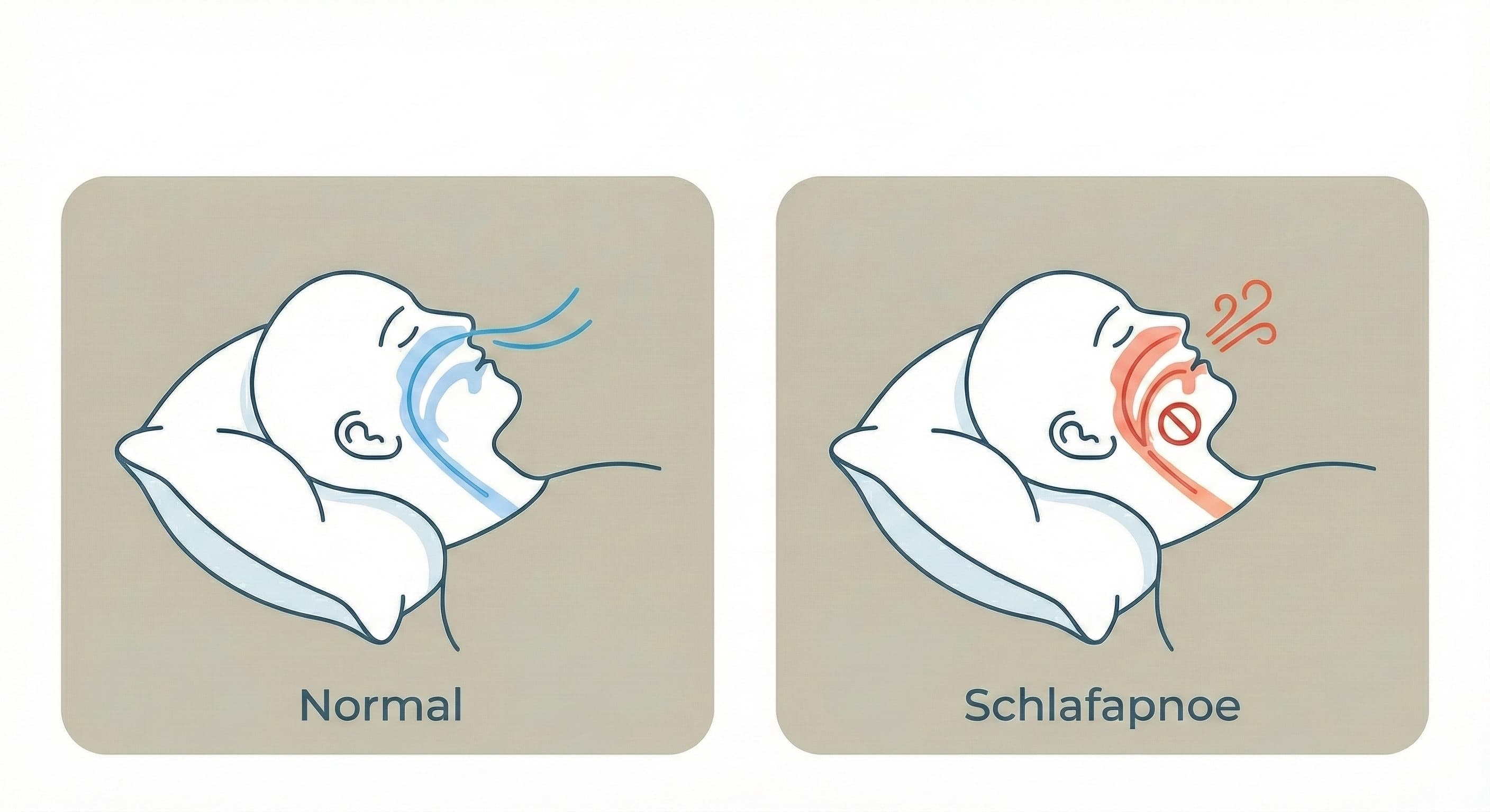 Die neuen S3-Leitlinien zur Schlafapnoe und ihre Bedeutung für Patienten